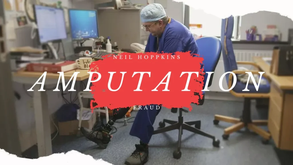 Surgeon goes Rougue---Neil Hoppkins Amputation Fraud